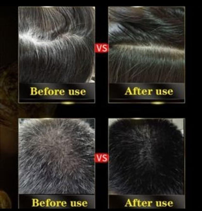 BlackRoot 3-in-1 Hair Dye Shampoo (Pack of 2)